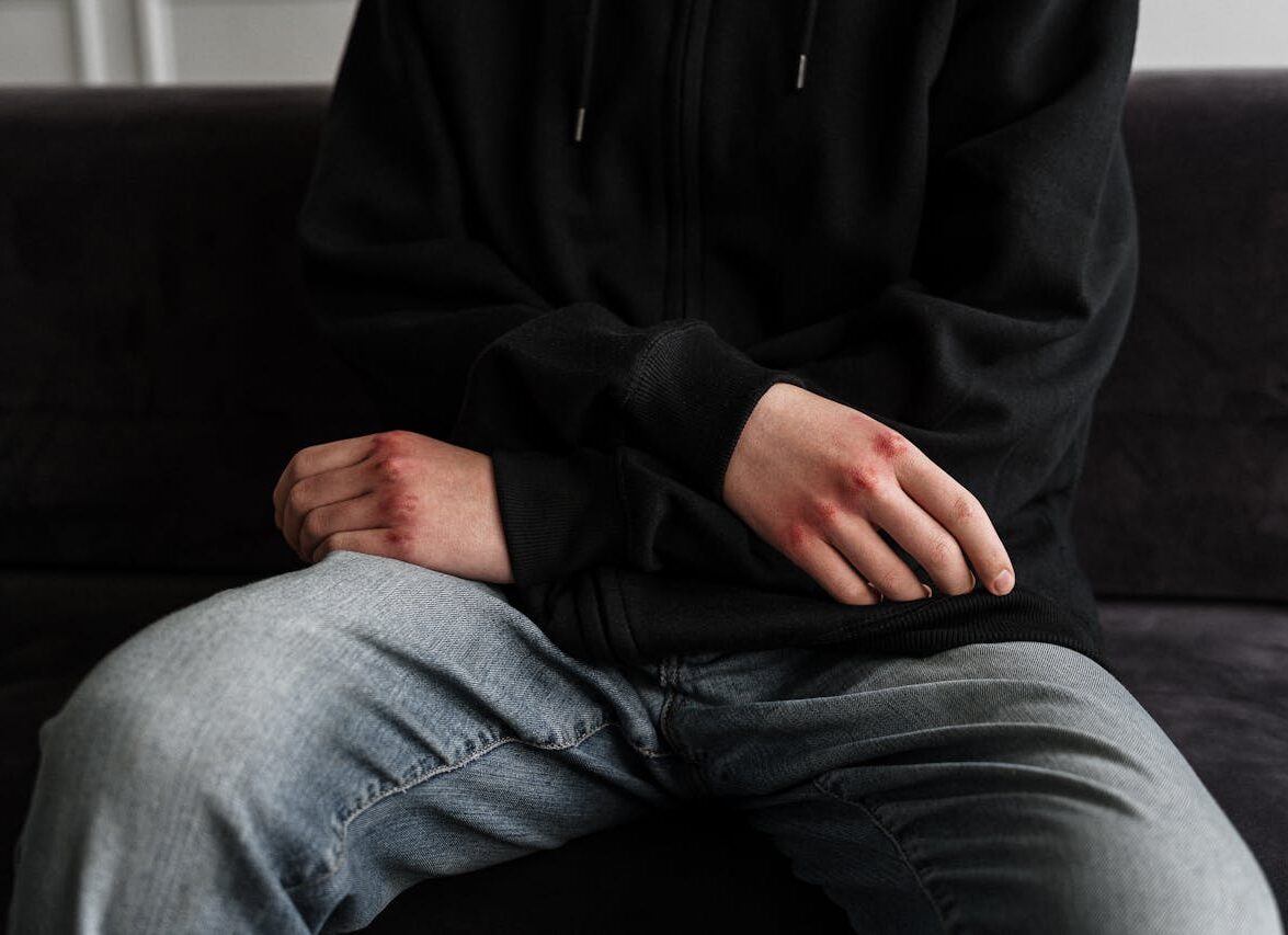 sünnet derisi restorasyonu aletleri ağrı yapar mı